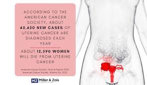 uterine cancer misdiagnosis baltimore