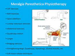 meralgia paresthetica physiotherapy