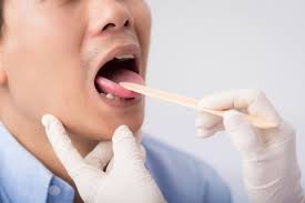 numb lips mouth or tongue 12 causes