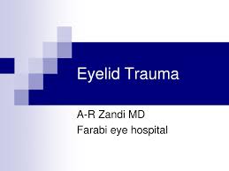 ppt eyelid trauma powerpoint