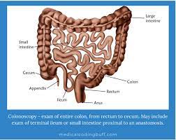 screening colonoscopy and polyp removal