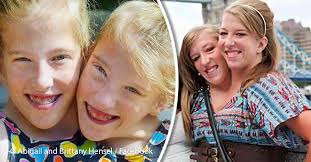 Abigail lorraine and brittany lee hensel were born on march 7, 1990 in a small town in minnesota. Conjoined Twins Abby And Brittany Hensel Are One Of A Kind See Where Are They Now