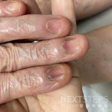fingernail scarring friday pop quiz 7