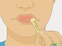 how to heal a swollen lip quickly 11