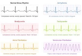 Electrocardiography Bioninja