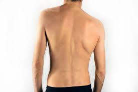 the most effective treatments for scoliosis