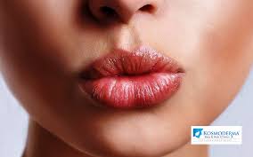 beautify your pout kosmoderma