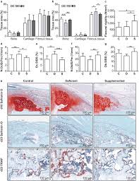 calcium and vitamin d deficiency