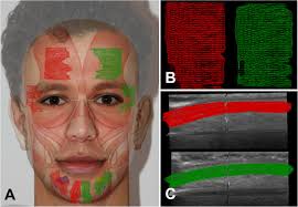 83,000+ vectors, stock photos & psd files. Normal Healthy Human Face Superimposition Of Facial Muscles And Download Scientific Diagram