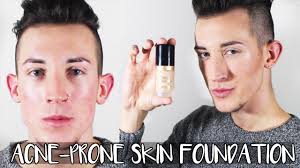 natural makeup for men acne acne