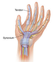 Movement of tendon will be detected optoelectronic sensor which is fixed on the stamp of the hand. Understanding Infectious Tenosynovitis Of The Finger Hand Or Wrist Saint Luke S Health System