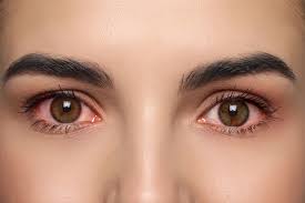 dry eyes vs eye infection symptoms