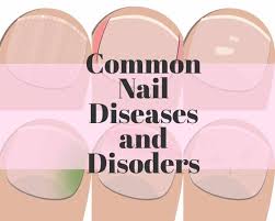 13 common nail diseases and disorders
