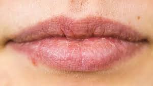 home remes for chapped lips