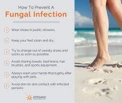 the most common fungal infections