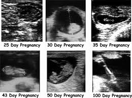 Ultrasound Images Of Embryo Or Fetal Development At Various