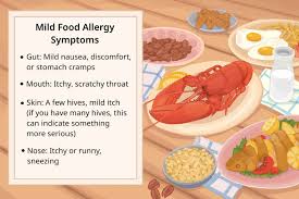 food allergy symptoms common reactions