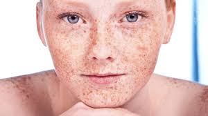makeup tips for freckles redheads