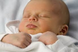 newborn neonatal jaundice