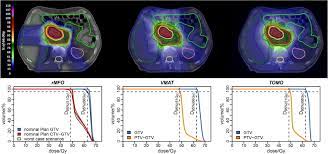 proton therapy in pancreatic cancer