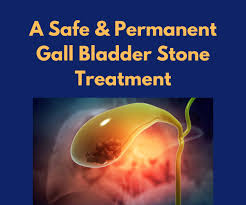 gall bladder stone treatment in