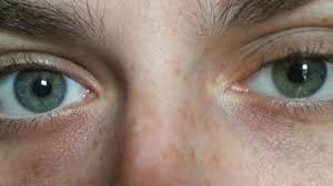 Grey Eyes Learn About A Rare Smokey Eye Color Guy