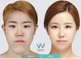 They were as cute and beautiful as they are today when in their younger age. Why Do Majority Of Female Korean Celebrities Do Plastic Surgery Why Do It When Majority Of Koreans Are Monolids Quora