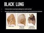 black lung disease