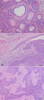 dog squamous cell carcinomas sccs