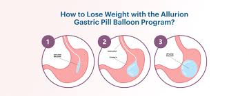 does alli weight loss pill work