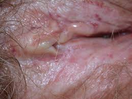 rash causes and how it s treated