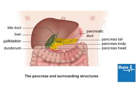 Pancreatitis Health Information Bupa Uk