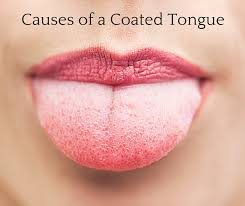 Learn The Causes Of A Coated Tongue Dr Chauvin