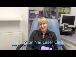 the london nail laser clinic fungal