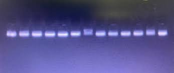 gel electropsis of genomic dna with