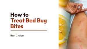 12 easy steps to treat bed bug bites