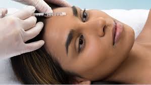does botox cost in california maryland