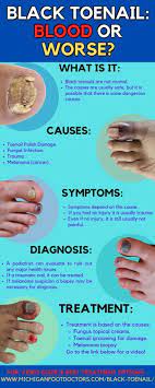 bruising under the toenails causes