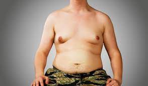 Fat Nipples In Men - Causes and Solutions | X-Sculpt Chicago