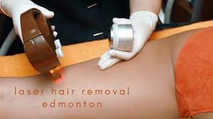 You may still be able to see a flash of light, but your eyes will. 7 Best Laser Hair Removal In Edmonton 2021