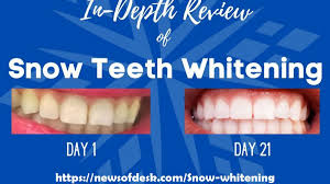 snow teeth whitening reviews in depth