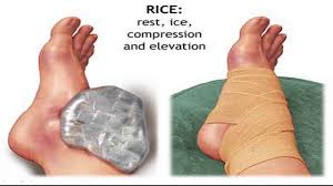 ankle sprain home treatment doctor