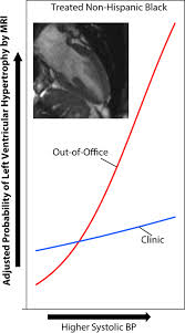 Superiority Of Out Of Office Blood Pressure For Predicting