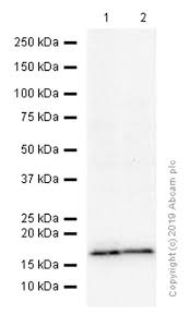 We don't share or showcase them either. Recombinant Anti Nme2 Antibody Epr8351 Ab131329 Abcam