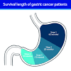 Since stomach cancer does not cause early symptoms, it often goes undiagnosed until stomach cancer is directly proportional, characterized or linked malignancy and tumor in the stomach(gaster). 1