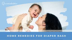 tips for treating diaper rash at home