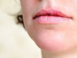 skin s on lips causes and treatment