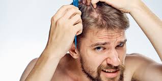 protein deficiency and hair loss
