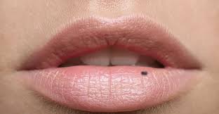 what causes black spot on your lips