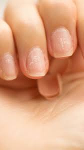 white spots on your nails indicate